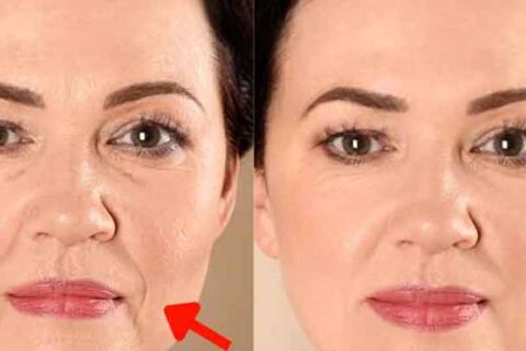 old woman before after