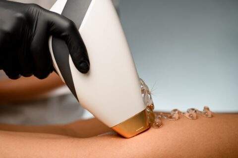 Professional in black gloves and light removes hair on legs in SPA salon. Flash diode laser hair removal.